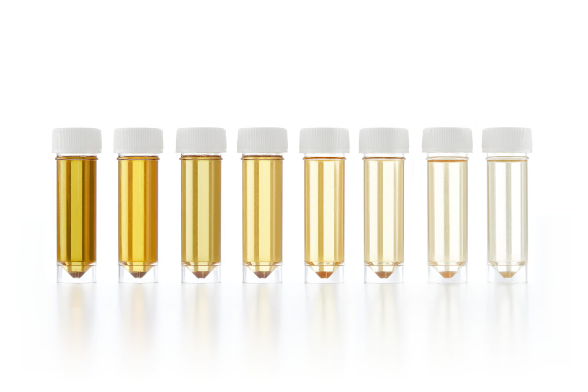 Urine samples for analysis